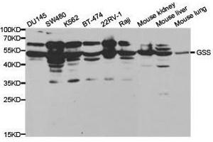 Western Blotting (WB) image for anti-Glutathione Synthetase (GSS) antibody (ABIN1872909) (Glutathione Synthetase Antikörper)