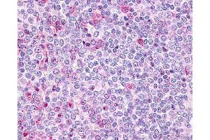 Image no. 1 for anti-Purinergic Receptor P2Y, G-Protein Coupled, 10 (P2RY10) (Extracellular Domain) antibody (ABIN121972)