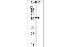 LOC129293 Antibody (C-term) (ABIN655687 and ABIN2845146) western blot analysis in SK-BR-3 cell line lysates (35 μg/lane).