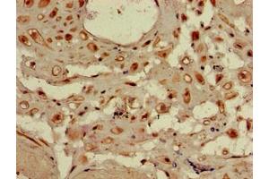 Immunohistochemistry of paraffin-embedded human placenta tissue using ABIN7175730 at dilution of 1:100