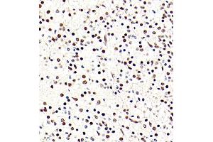 Immunohistochemistry of paraffin embedded rat embryonic rat using BRN3A (ABIN7075163) at dilution of 1:700 (400x lens)