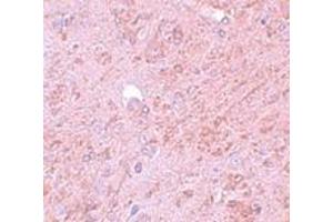Immunohistochemistry (IHC) image for anti-Protein Inhibitor of Activated STAT, 4 (PIAS4) (N-Term) antibody (ABIN1031512)