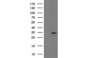 Western Blotting (WB) image for anti-Haloacid Dehalogenase-Like Hydrolase Domain Containing 2 (HDHD2) antibody (ABIN1498628) (HDHD2 Antikörper)