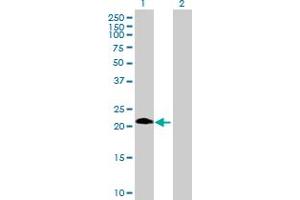 Western Blot analysis of ASB6 expression in transfected 293T cell line by ASB6 MaxPab polyclonal antibody. (ASB6 Antikörper  (AA 1-197))