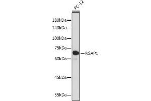 Western blot analysis of extracts of PC-12 cells, using RG antibody (ABIN7269819) at 1:1000 dilution. (RACGAP1 Antikörper)