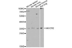 Western blot analysis of extracts of various cell lines, using HAVCR2 antibody. (TIM3 Antikörper  (AA 22-202))