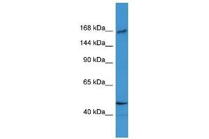 Western Blot showing BTBD12 antibody used at a concentration of 1-2 ug/ml to detect its target protein.