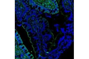 IF analysis of Villin using anti-Villin antibody (ABIN3042343). (Villin 1 Antikörper  (C-Term))