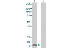Western Blot analysis of IFNA2 expression in transfected 293T cell line by IFNA2 monoclonal antibody (M37), clone 2D6. (IFNA2 Antikörper  (AA 24-188))