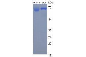 Image no. 1 for Vitamin A protein (BSA) (ABIN1880113) (Vitamin A Protein (BSA))