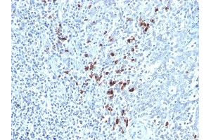 Formalin-fixed, paraffin-embedded human Tonsil stained with Kappa Light Chain Mouse Monoclonal Antibody (KLC264). (IGKC Antikörper)