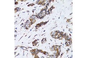 Immunohistochemistry (Paraffin-embedded Sections) (IHC (p)) image for anti-Progesterone Receptor Membrane Component 1 (PGRMC1) (AA 44-195) antibody (ABIN6145520)