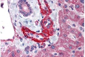 Immunohistochemistry (IHC) image for anti-Angiotensinogen (serpin Peptidase Inhibitor, Clade A, Member 8) (AGT) (Internal Region) antibody (ABIN1048321)