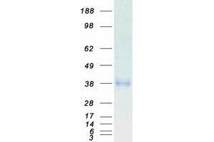 Western Blotting (WB) image for Fc Fragment of IgG, Low Affinity IIa, Receptor (CD32) (FCGR2A) (Transcript Variant 2) protein (Myc-DYKDDDDK Tag) (ABIN2713646)