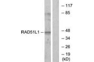 Western blot analysis of extracts from COS7 cells, using RAD51L1 Antibody. (RAD51 Homolog B Antikörper  (AA 201-250))