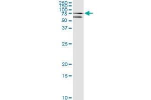 Immunoprecipitation (IP) image for anti-Cut-Like Homeobox 1 (CUX1) (AA 521-620) antibody (ABIN560539)