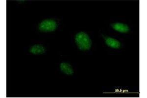 Immunofluorescence of purified MaxPab antibody to ARL3 on HeLa cell. (ARL3 Antikörper  (AA 1-182))
