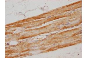 IHC image of ABIN7160584 diluted at 1:100 and staining in paraffin-embedded human skeletal muscle tissue performed on a Leica BondTM system.