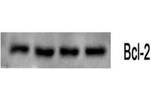 Western Blot (WB) analysis: Please contact us for more details. (Bcl-2 Antikörper)
