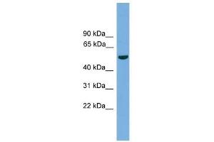 TMPRSS4 antibody used at 0. (TMPRSS4 Antikörper  (N-Term))