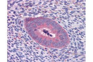 Anti-GART antibody IHC of human uterus. (GART Antikörper  (AA 1-434))