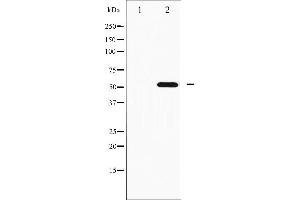 Western blot analysis of p70 S6 Kinase beta phosphorylation expression in EGF treated K562 whole cell lysates,The lane on the left is treated with the antigen-specific peptide. (RPS6KB2 Antikörper  (pSer423))