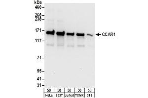 Western Blotting (WB) image for anti-Cell Division Cycle and Apoptosis Regulator 1 (CCAR1) (AA 1-50) antibody (ABIN7454629)