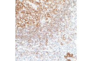 Immunohistochemistry (IHC) image for anti-CD40 (CD40) (AA 227-277) antibody (ABIN7454023) (Rekombinanter CD40 Antikörper  (AA 227-277))