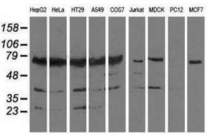 Image no. 2 for anti-Pseudouridylate Synthase 7 Homolog (PUS7) antibody (ABIN1500515)
