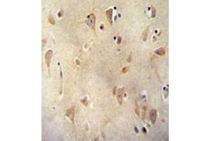 Immunohistochemistry analysis in formalin fixed and paraffin embedded human brain tissue reacted with  LRRC40 Antibody (C-term) followed which was peroxidase conjugated to the secondary antibody and followed by  DAB staining. (LRRC40 Antikörper  (C-Term))