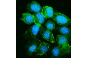 IF analysis of YARS1 using anti-YARS1 antibody (ABIN7601158). (YARS1 (AA 294-523) Antikörper)