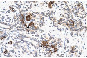 Human Pancreas (MEK2 Antikörper  (C-Term))