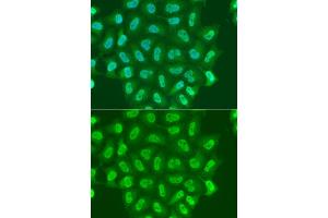 Immunofluorescence analysis of A549 cell using POLR2A antibody.