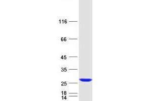 Validation with Western Blot (RAB38 Protein (Myc-DYKDDDDK Tag))