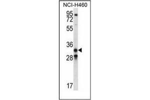 Western blot analysis of GDF15 Antibody (N-term) in NCI-H460 cell line lysates (35ug/lane). (GDF15 Antikörper  (N-Term))