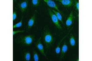 IF analysis of TOMM20 using anti-TOMM20 antibody (ABIN7600883). (TOMM20 Antikörper  (AA 25-145))