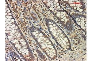 Immunohistochemistry (Paraffin-embedded Sections) (IHC (p)) image for anti-TGF beta Receptor 1 (AA 301-400) antibody (ABIN671256)