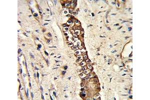 Immunohistochemistry (IHC) image for anti-Discoidin Domain Receptor tyrosine Kinase 2 (DDR2) antibody (ABIN3030741)