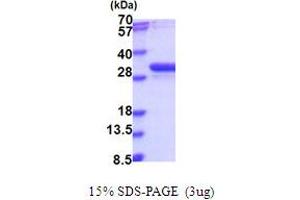 SDS-PAGE (SDS) image for Nucleotide Binding Protein 2 (NUBP2) (AA 1-271) protein (His tag) (ABIN5853987) (NUBP2 Protein (AA 1-271) (His tag))