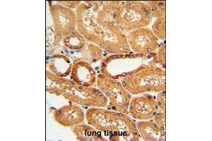 COQ9 Antibody immunohistochemistry analysis in formalin fixed and paraffin embedded human lung tissue followed by peroxidase conjugation of the secondary antibody and DAB staining. (COQ9 Antikörper  (AA 156-184))