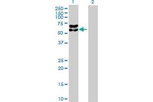 Western Blot analysis of BACE1 expression in transfected 293T cell line by BACE1 MaxPab polyclonal antibody. (BACE1 Antikörper  (AA 1-476))