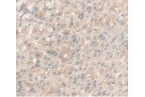 IHC-P analysis of Rat Stomach Tissue, with DAB staining. (Androgen Receptor Antikörper  (AA 491-679))