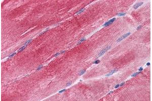 Human Skeletal Muscle: Formalin-Fixed, Paraffin-Embedded (FFPE) (BAG3 Antikörper  (AA 563-575))