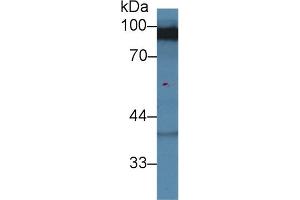 Western blot analysis of Rat Cerebrum lysate, using Human DLG3 Antibody (2 µg/ml) and HRP-conjugated Goat Anti-Rabbit antibody ( (MPP3 Antikörper  (AA 627-802))