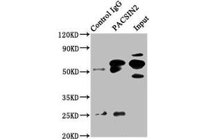 Immunoprecipitating PACSIN2 in HepG2 whole cell lysate Lane 1: Rabbit control IgG instead of ABIN7165686 in HepG2 whole cell lysate. (PACSIN2 Antikörper  (AA 240-410))