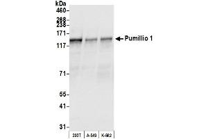anti-Pumilio Homolog 1 (PUM1) (AA 225-275) antibody
