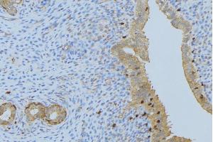 ABIN6275893 at 1/100 staining Human uterus tissue by IHC-P. (CPA1 Antikörper  (Internal Region))
