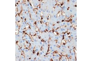 Immunohistochemistry of paraffin-embedded human liver using S100 Rabbit mAb (ABIN7270127) at dilution of 1:100 (40x lens). (S100A6 Antikörper)