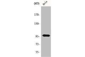 Western Blot analysis of HeLa cells using GAP1-InsP4 BP Polyclonal Antibody (RASA3 Antikörper  (Internal Region))