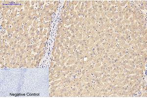 Immunohistochemical analysis of paraffin-embedded human liver tissue.